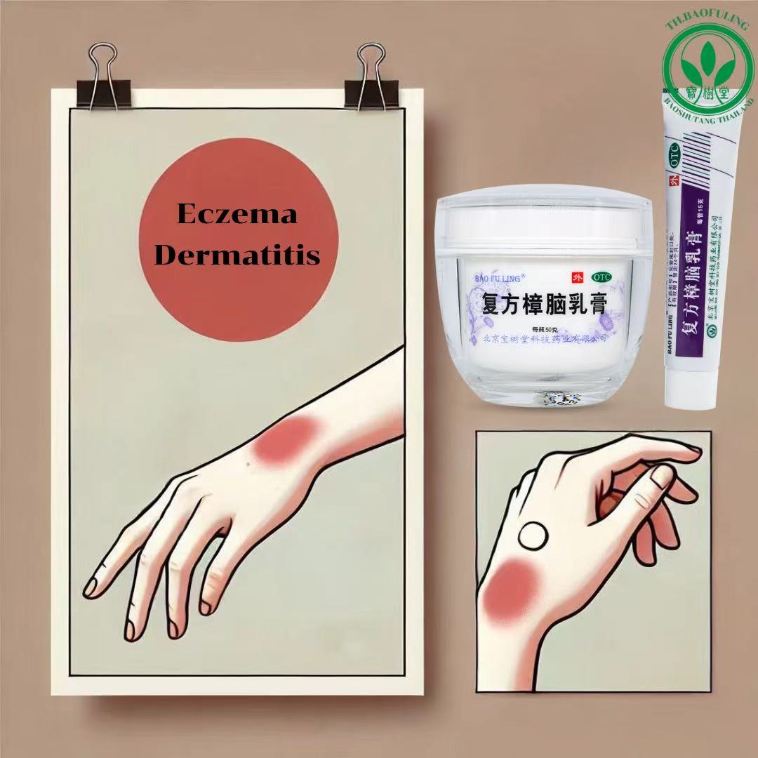Baofuling By Baoshutang กับการบรรเทาอาการของโรคผิวหนังอักเสบ (Dermatitis)